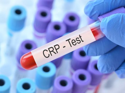 Protéine C réactive haut : causes, symptômes et solutions