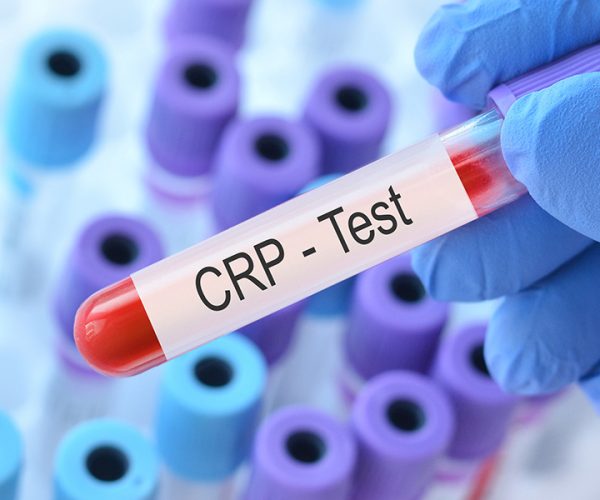 Protéine C réactive haut : causes, symptômes et solutions