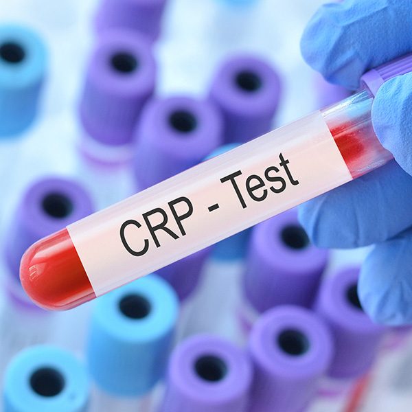 Protéine C réactive haut : causes, symptômes et solutions